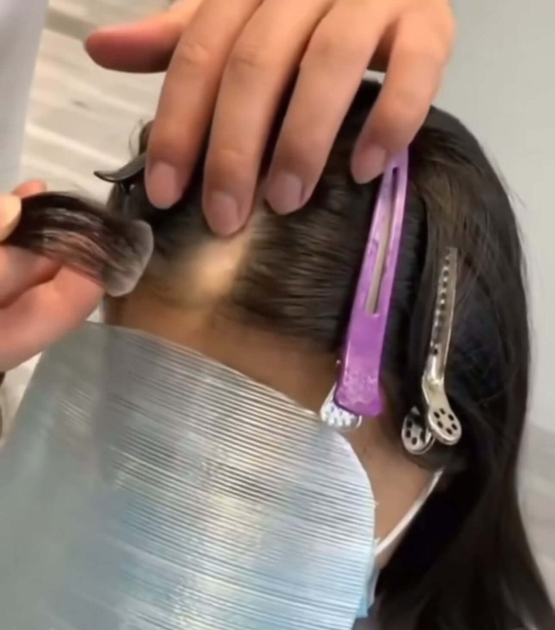 Understanding Frontal Fibrosing Alopecia (FFA) Hair Loss and How Our Bold Spot Hairpieces Can Help